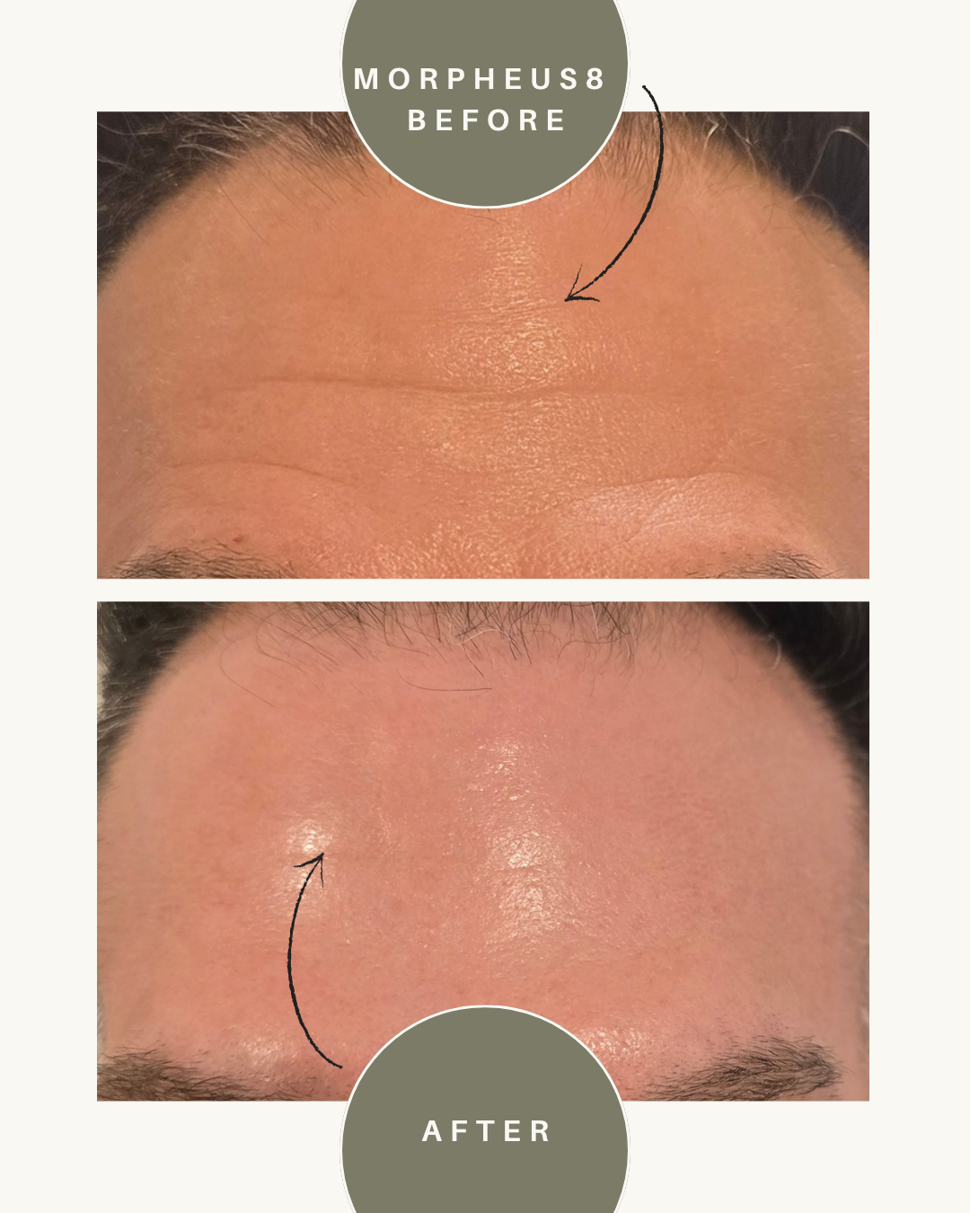 before and after